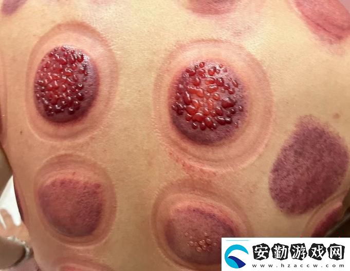 太粗大深好疼快拔出去怎么辦網(wǎng)友