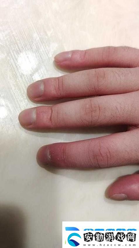 寶寶才兩根手指就疼哭了怎么回事
