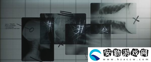 寂靜嶺2重制版醫(yī)院三樓轉(zhuǎn)盤鎖怎么開